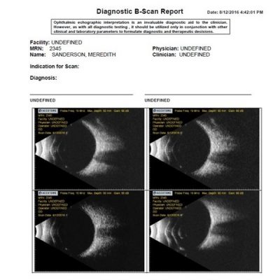 B-Scan Plus – Ophthalmic Singapore